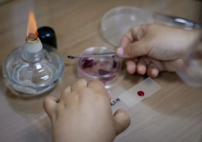 新闻能见度｜过敏季战花粉(图9)