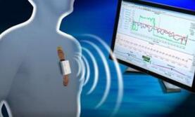 熊猫体育官方网站三诺生物一季度归母净利润9769万元同比上升355%